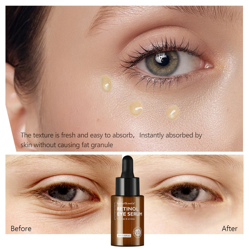 Sérum para Olhos com Retinol 30ML – Anti-Rugas, Remove Olheiras e Inchaço, Reduz Linhas Finas e Hidrata