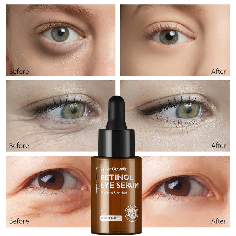 Sérum para Olhos com Retinol 30ML – Anti-Rugas, Remove Olheiras e Inchaço, Reduz Linhas Finas e Hidrata