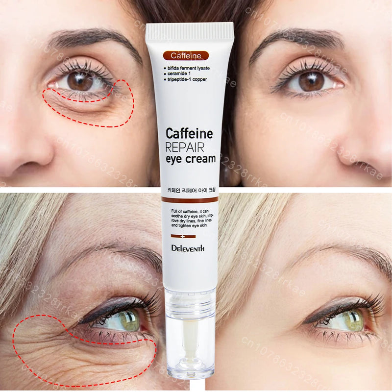 Creme para Olhos – Remove Olheiras, Bolsas, Inchaço e Rugas