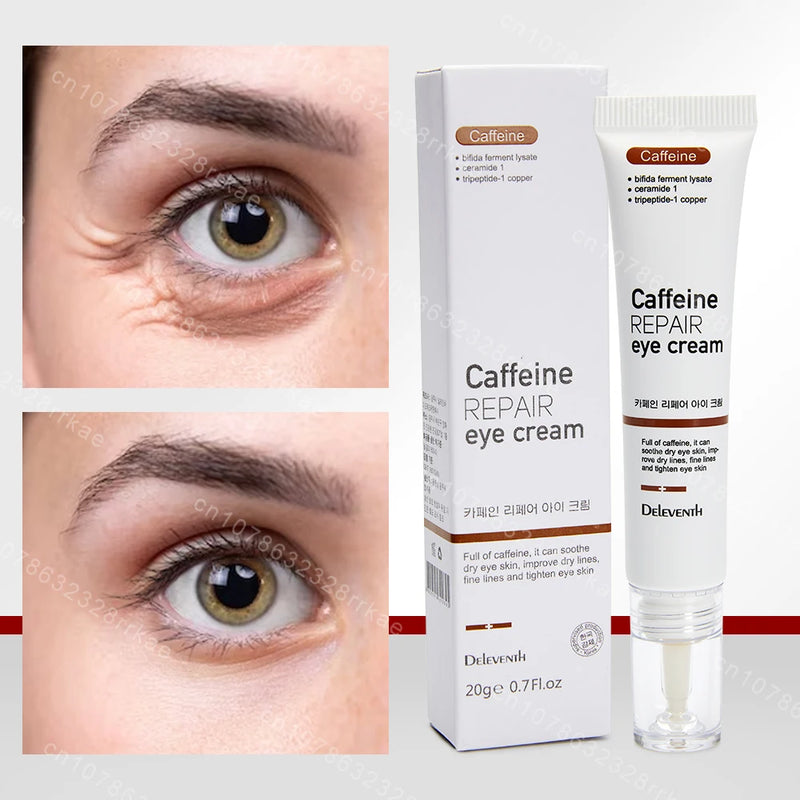 Creme para Olhos – Remove Olheiras, Bolsas, Inchaço e Rugas